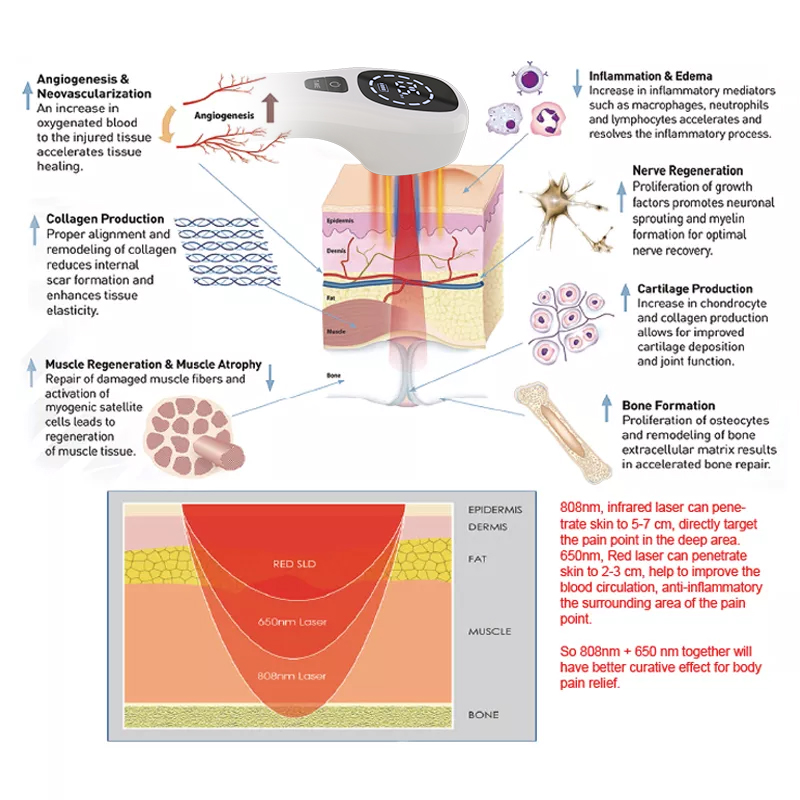 Dispositivo per terapia laser  - Badminton Bag recensione e prezzo